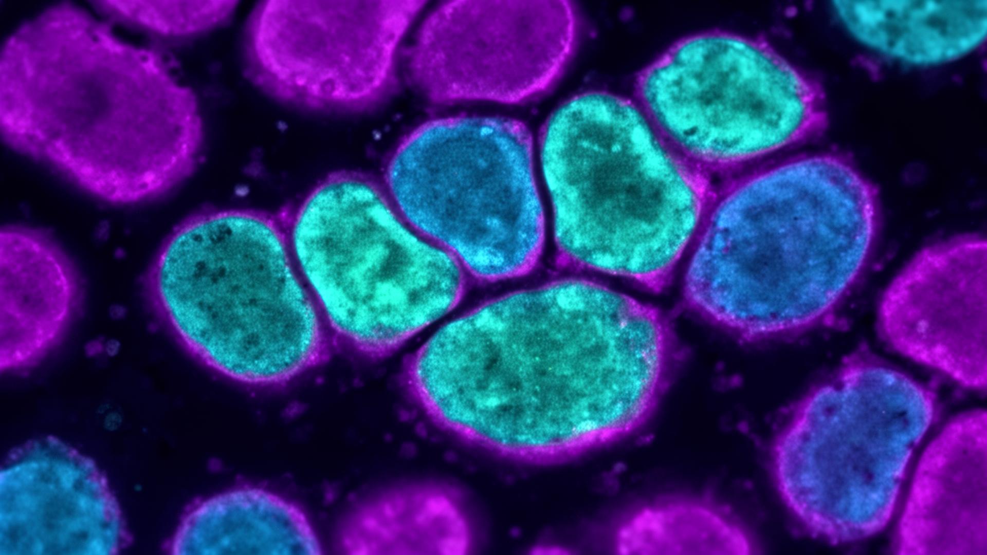 Pancreatic cell microscopy